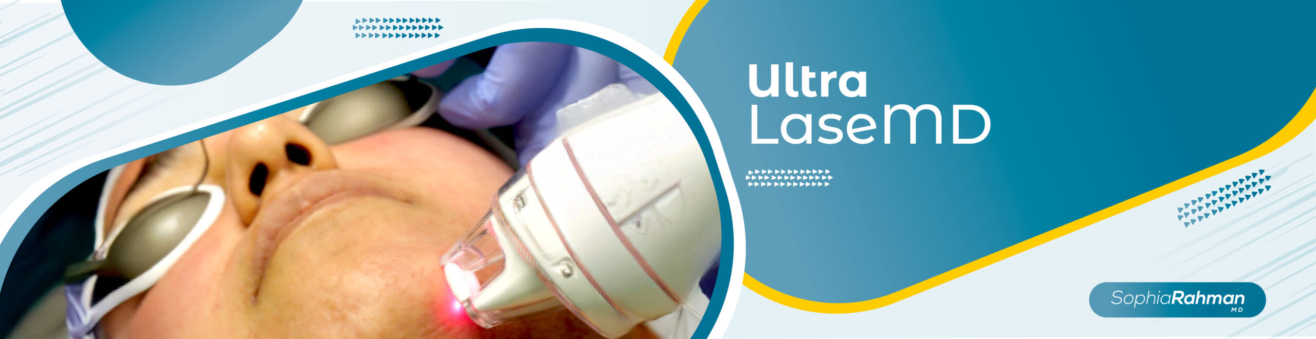 LaseMD Ultra Laser Resurfacing