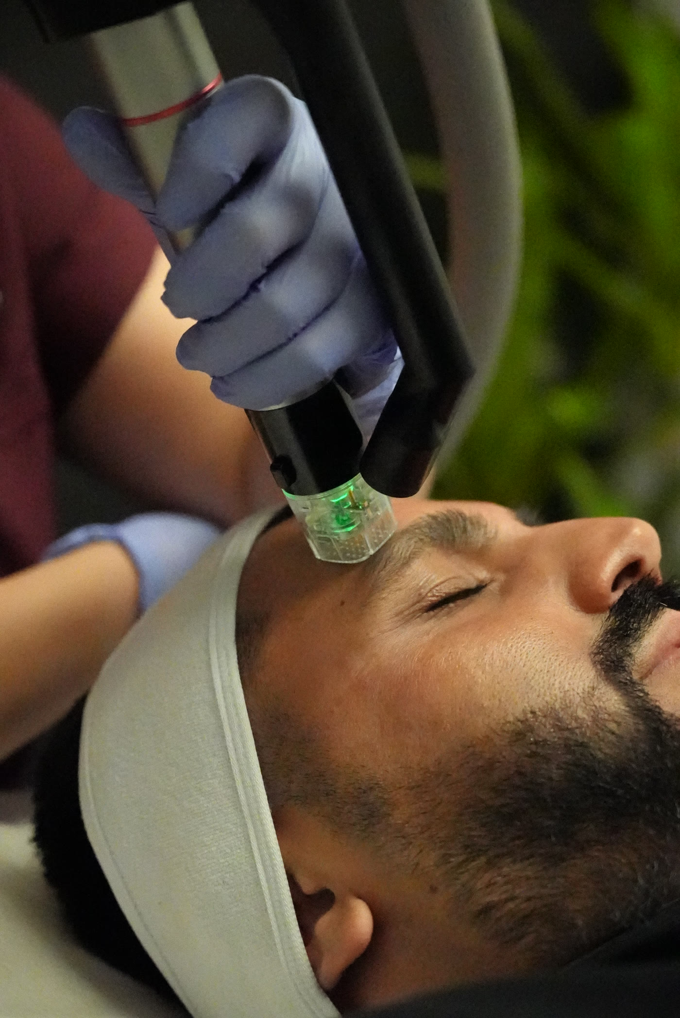 Genius RF microneedling handpiece
